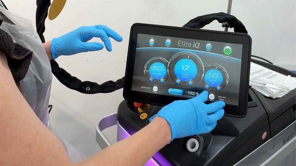 My Laser Hair Removal Journey at Calveo, Ashwell Near Oakham, Rutland