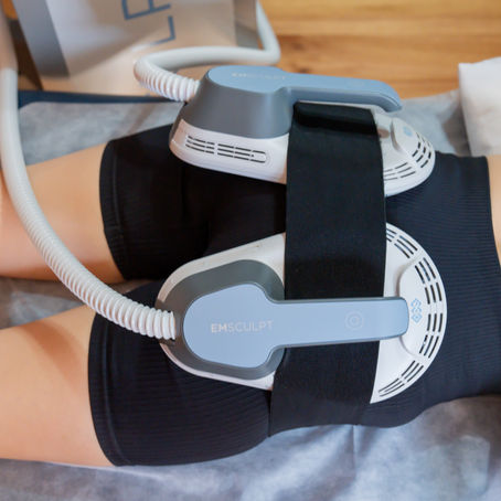 Maintenance afer non-surgical body contouring treatments