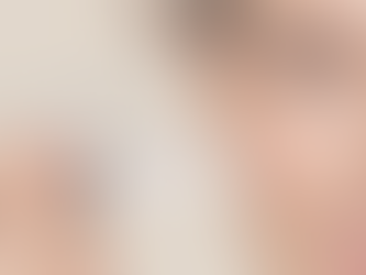 Microneedling with PRP vs Microneedling with Exosomes: Which Treatment Is Best for Your Skin