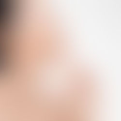 Chin Botox Toronto: Solution to a Dimpled Chin