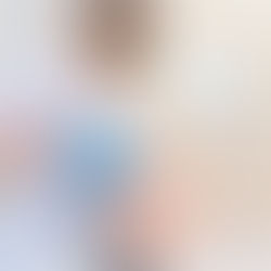 IPL PHOTOREJUVENATION