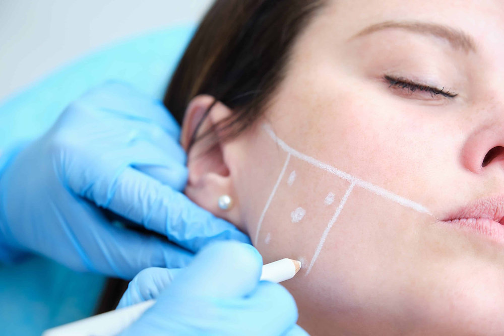 Botox Facial Slimming in Toronto