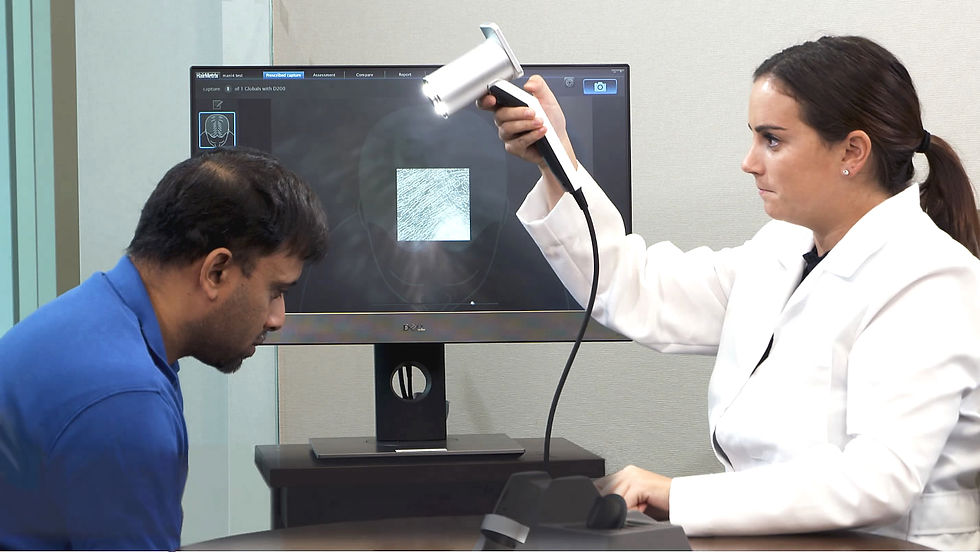 Close-up view of HairMetrix device capturing high-resolution images of scalp and hair follicles