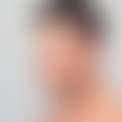 Jaw Contouring: One Of The Newest Beauty Trends in Aesthetic Medicine