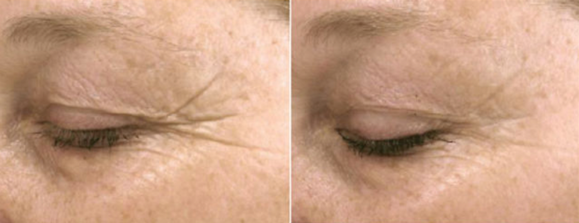 Exosomes Rejuvenus.png.png