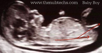 ultrasound scan