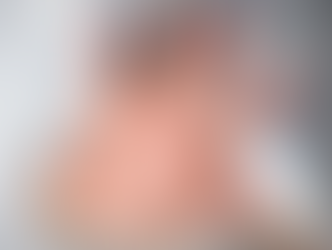 Posibles casos de sarampión en México