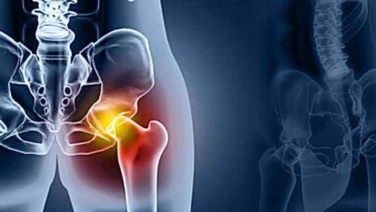 Hip injuries