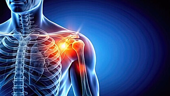 Shoulder injuries