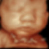 35 Weeks