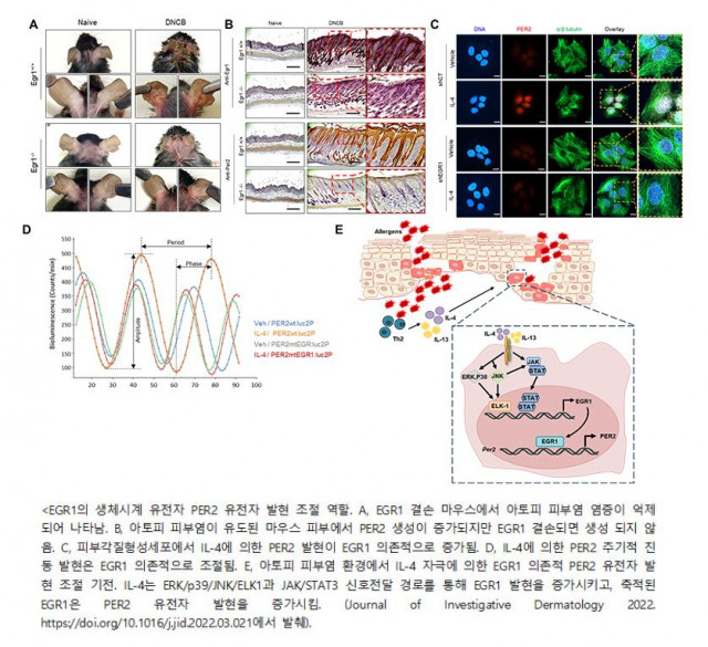건국대 신순영 교수팀, ‘아토피 피부염에서 생체 리듬 교란’ 규명
