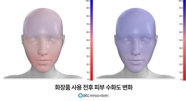OATC 피부임상시험센터, 피부 ‘수치 시각화 프로그램’ 도입