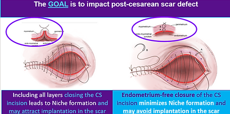 Lecture Series EFCT Closure Technique