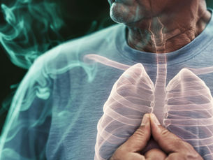 Pulmonary Embolism: What You Need to Know About This Serious Lung Condition