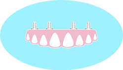 IMPIANTI