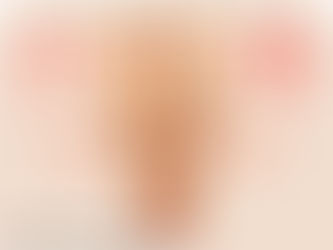 DMSO Anwendung statt Skalpell: Revolutionäre Methode Krampfadern zu behandeln