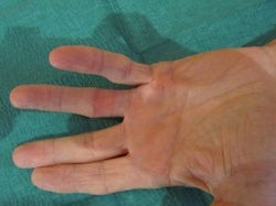 Após o tratamento III