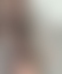 messy poorly done tattoos on an arm to show a before image for a cover-up tattoo