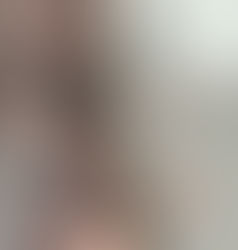 messy poorly done tattoos on an arm to show a before image for a cover-up tattoo