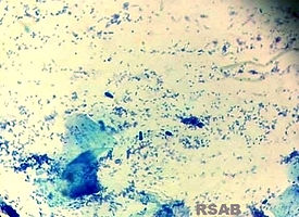 Bacterias cocos