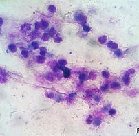 Células inflamatórias