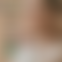 Aceite de Moringa la maravilla para la piel 