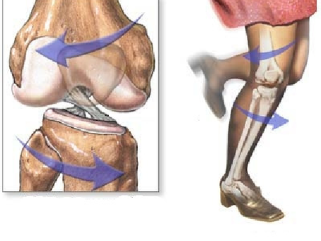 Ligamento Cruzado Anterior (LCA)