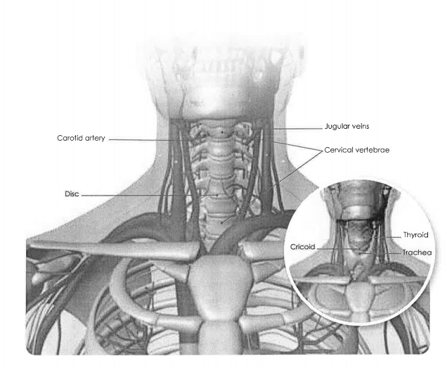 Should the Police Ban use of Choke Holds?