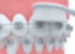 InitialC_AngleCare4-2-3.png