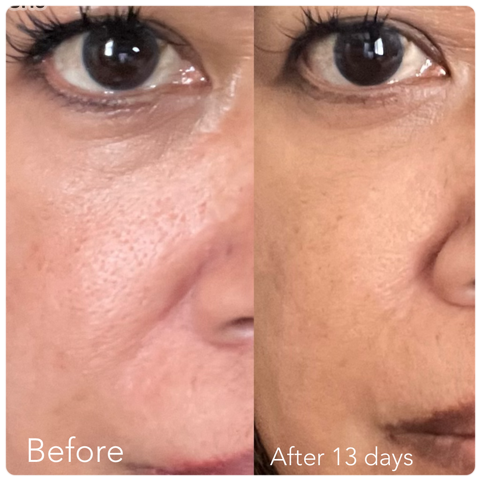 Thumbnail: F/A 100 Miracle Skin Repair