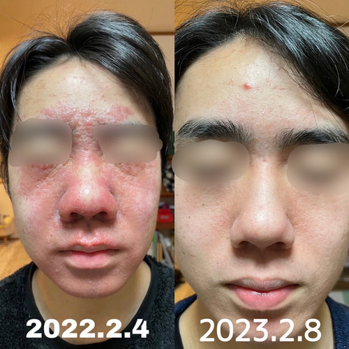 As_iris（アズイリス） | 経絡美容整体Labo Nahele