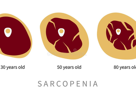 Sarcopenia: Age Related Loss of Muscle Mass and Strength
