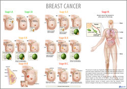 FB Breast Cancer.jpg