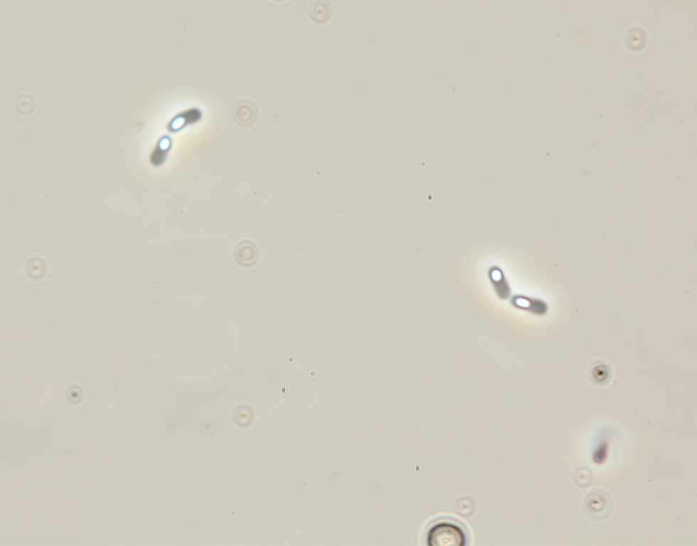 Romboutsia sp. cells with oval-shaped endospores.