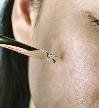 SKN BY SKY ACNE SCARS.jpg