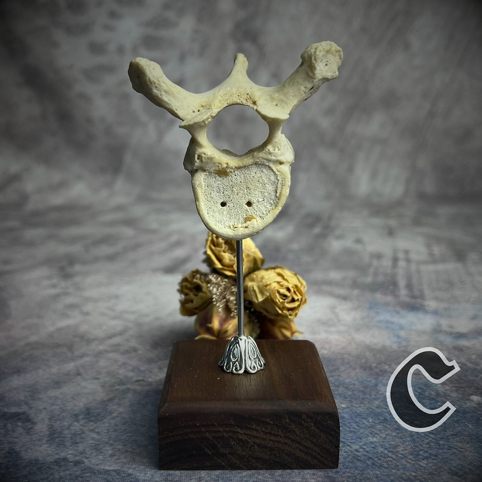 Thumbnail: Human Vertebrae on Display Stands