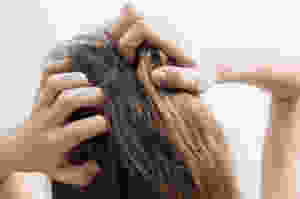 hair loss, itchy wig, scratching head, woman, stop wig shedding, head pat, result, lace wig how to, reduce, eliminate, stop