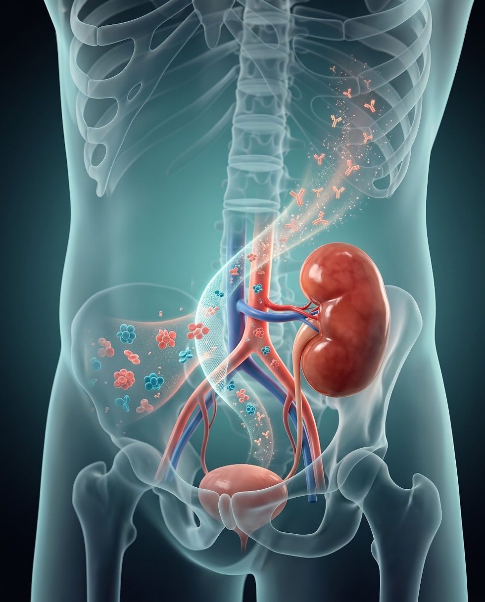 ABO-Incompatible & Complex Kidney Transplantation