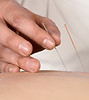 Love Co Acupuncture, Community Acupuncture, Fort Collins, Eastern Medicine