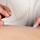 acupunture romford | osteopath in romford