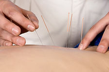 Medical Acupuncturist