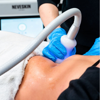 Neveskin-treatment.png
