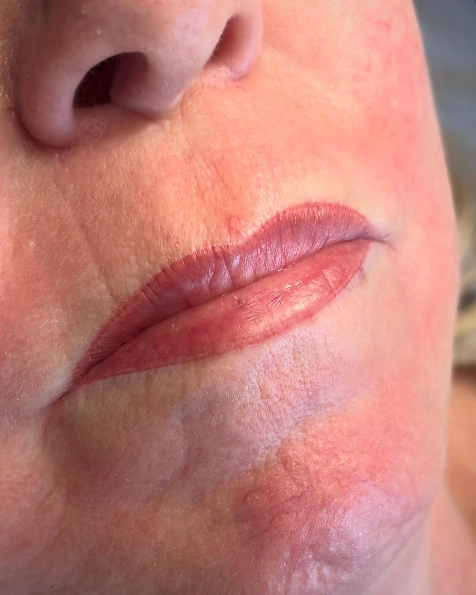 Huulten pigmentointi