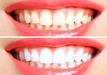 Cosmetic dentist near me