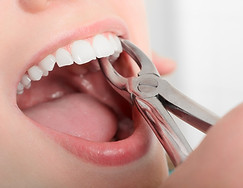 Emergency Dental Extraction Near Me Jamaica thumbnail