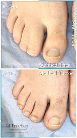 Webbed Toes Tattoo Male