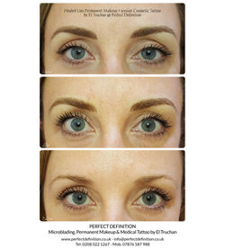 Healed after 1 session Eyebrows Microbla