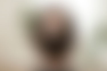 Back of a man’s head showing hair thinning and male pattern hair loss at the crown.