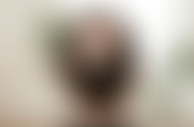 Back of a man’s head showing hair thinning and male pattern hair loss at the crown.