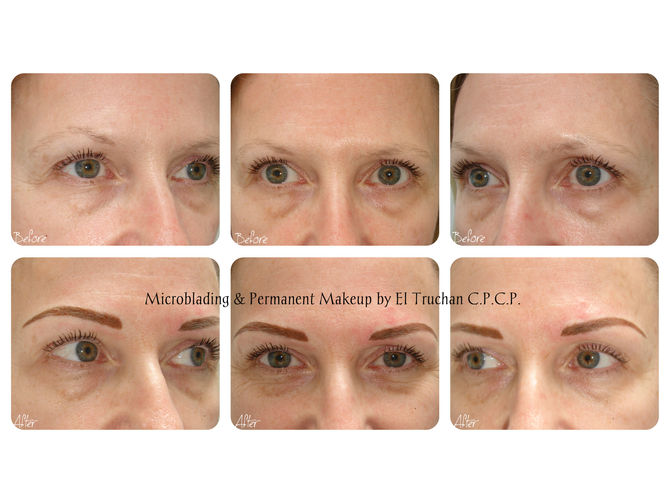 Eyebrow Lift & Restoration - Hairstroke Combination Eyebrows